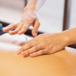 Acupuncture for Chronic Back Pain